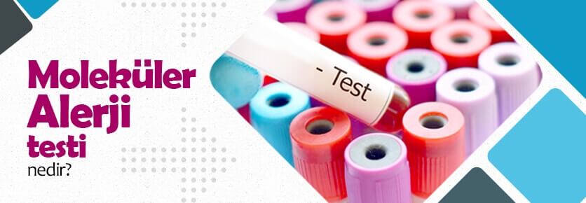 Moleküler Alerji Testi Nedir?
